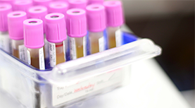 vials-277x153px vials-277x153px