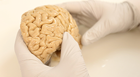 about-neurology-277x153px about-neurology-277x153px