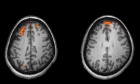Reliability of multimodal MRI brain measures in youth at risk for mental illness