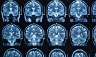 Cutting‑Edge Neuro‑MRI Technology to Set New Healthcare Standard