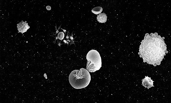 An image from Kim Morgan's "Blood and Breath, Skin and Dust" exhibition. (Kim Morgan) An image from Kim Morgan's "Blood and Breath, Skin and Dust" exhibition. (Kim Morgan)