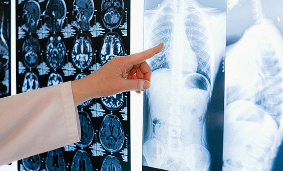 New M national study to uncover how biology, social factors shape MS outcomes – Dal News