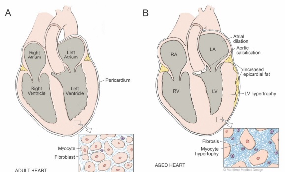 Research - Heart Health Lab - Dalhousie University